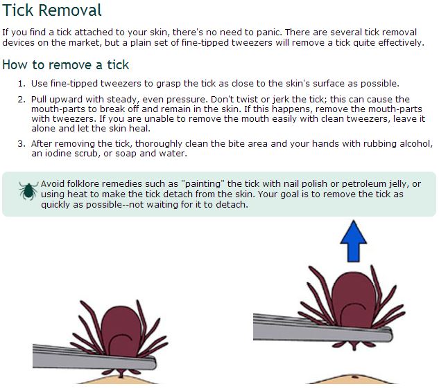 tick removal